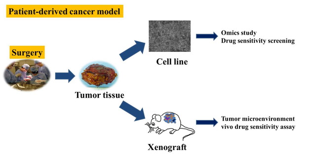 figure of Establishment of patient-derived cancer model