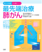 最先端治療 肺がん