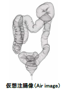 img11.png