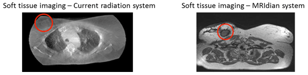 Soft tissue imaging