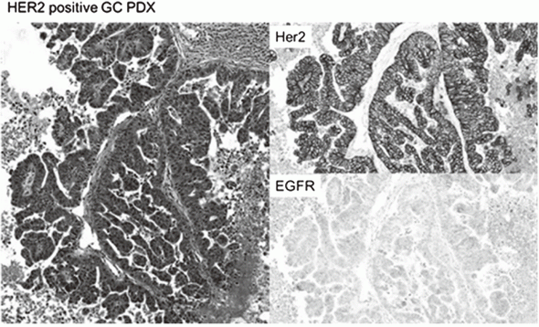 Figure 1. An established gastric cancer PDX model showing strong HER2 expression