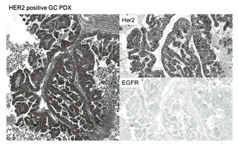 Figure 1. An established gastric cancer PDX model showing strong HER2 expression(Full Size)