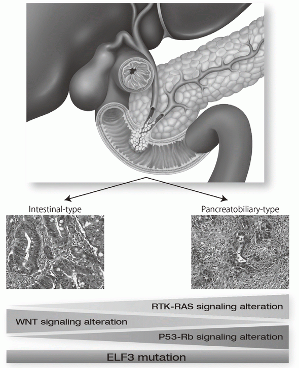 Figure 1. Genetic landscape of ampullary carcinomas