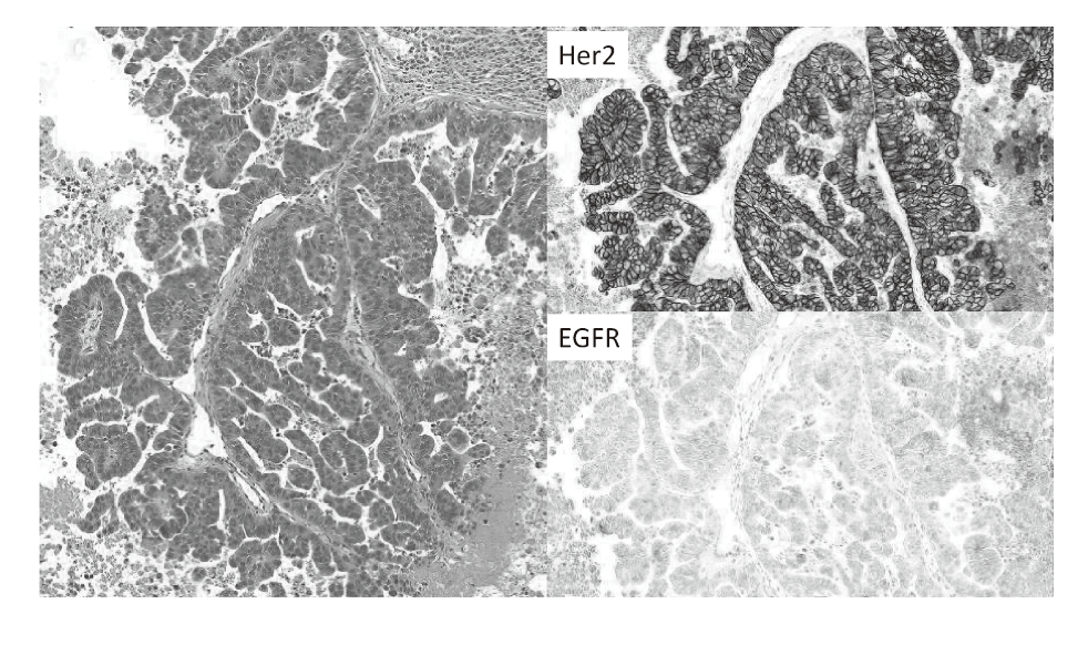 Figure 2. Pathological features of PDX(Full Size)