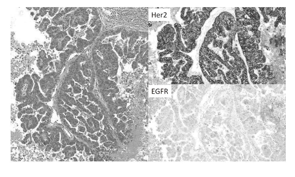 Figure 2.  Pathological features of PDX(Full Size)