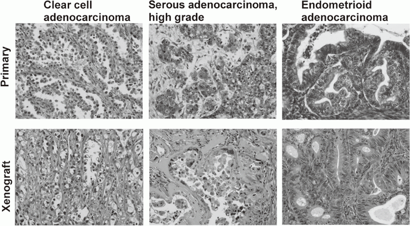 Figure 1. Pathological fidelity of xenograft tissue of newly established ovarian cancer cell lines