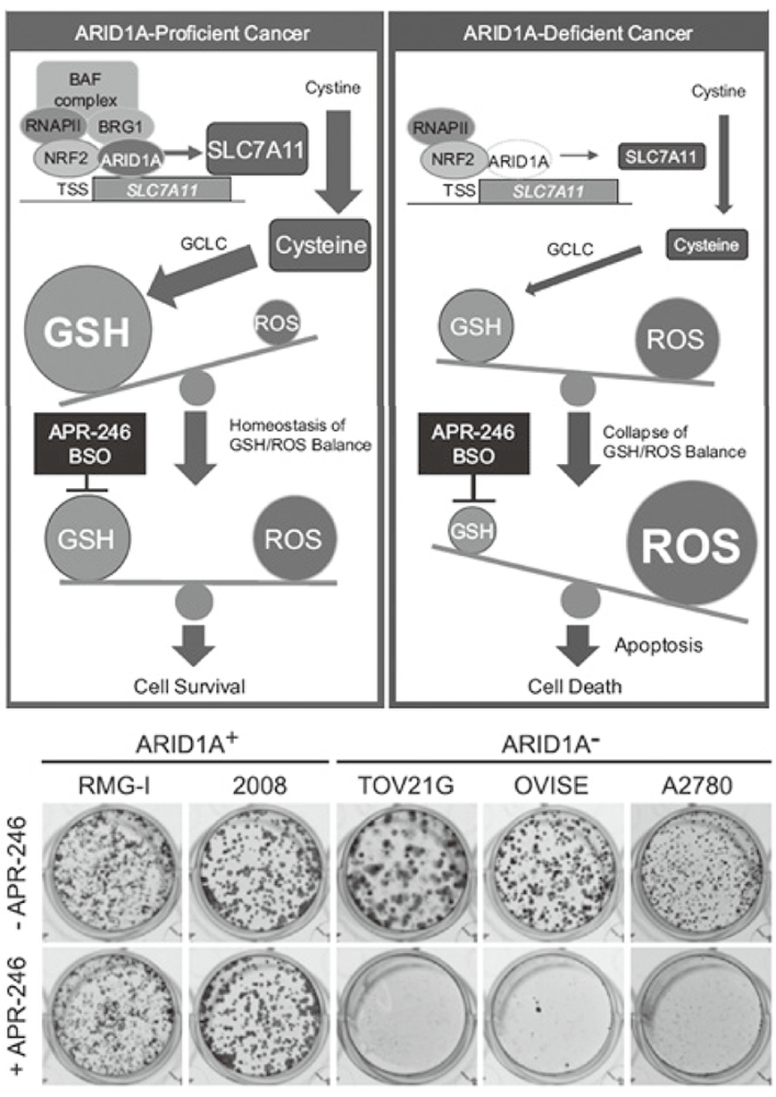 Figure 1. Targeting the vulnerability of glutathione metabolism in ARID1A-deficient cancers