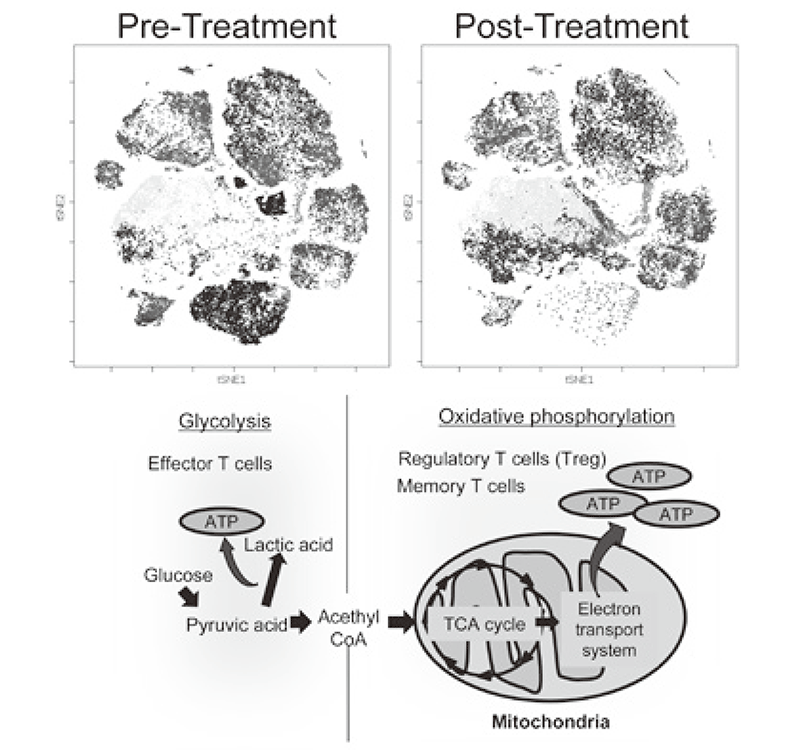 Figure 2. Representative image of clinical-sample analysis (pre- and post-treatments), and metabolic pathway map in lymphocytes(Full Size)