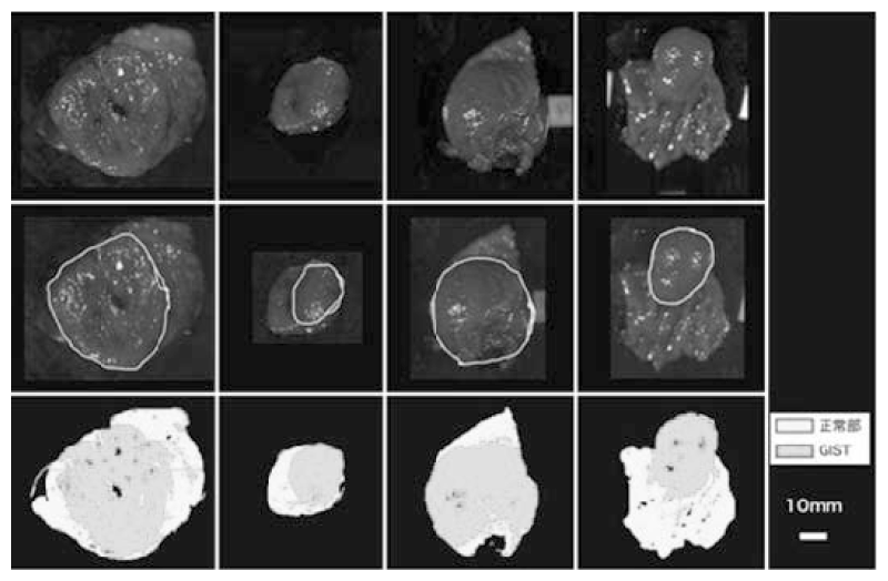 Figure 1.  Identification of GIST using near-infrared hyperspectral imaging