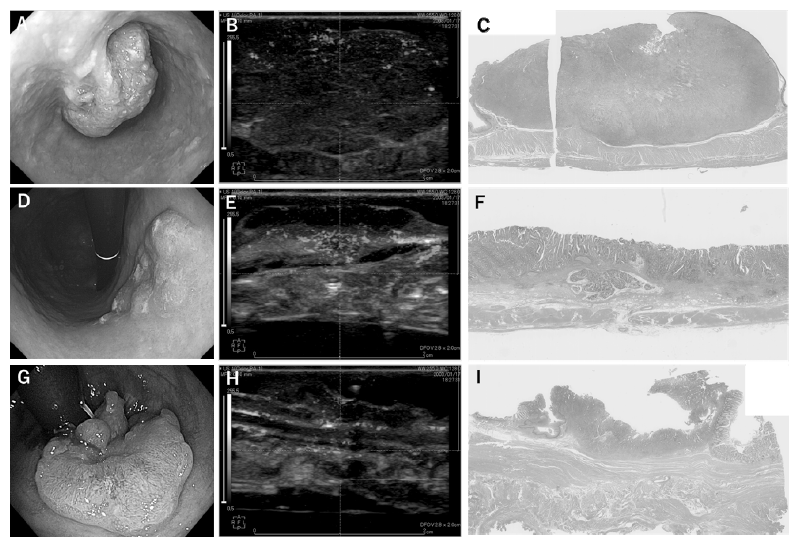Figure 2.  Deep gastrointestinal vascular images obtained using photoacoustic imaging