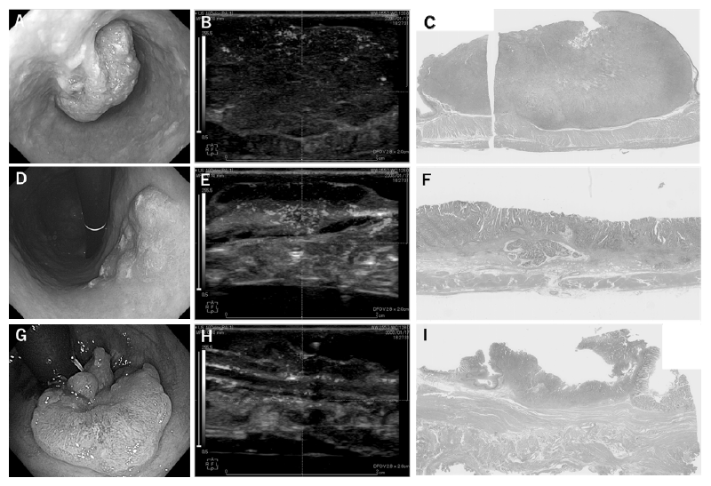 Figure 2. Deep gastrointestinal vascular images obtained using photoacoustic imaging