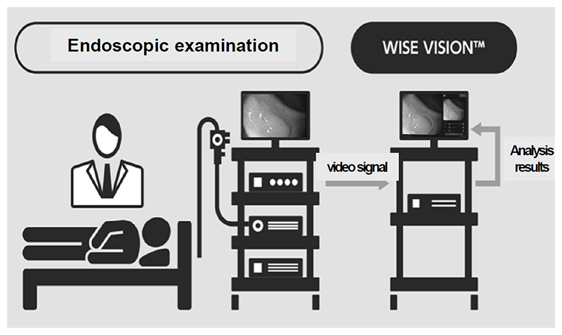 Figure 1. The endoscope AI system complied with the requirements for medical device approval in Japan and CE mark in Europe.