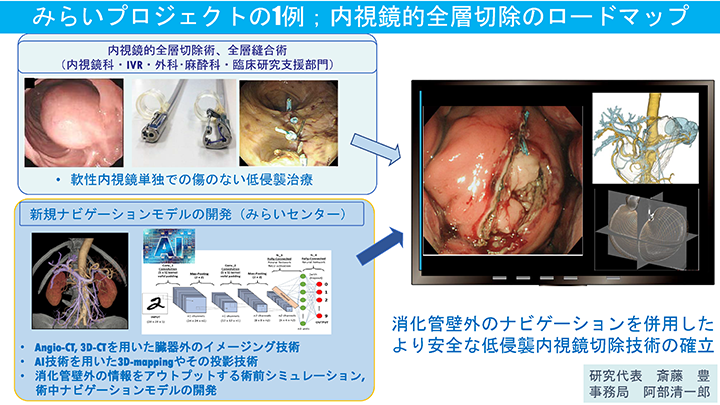 みらい Mirai プロジェクト 国立がん研究センター