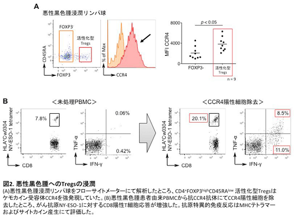 悪性黒色腫へのTregの浸潤