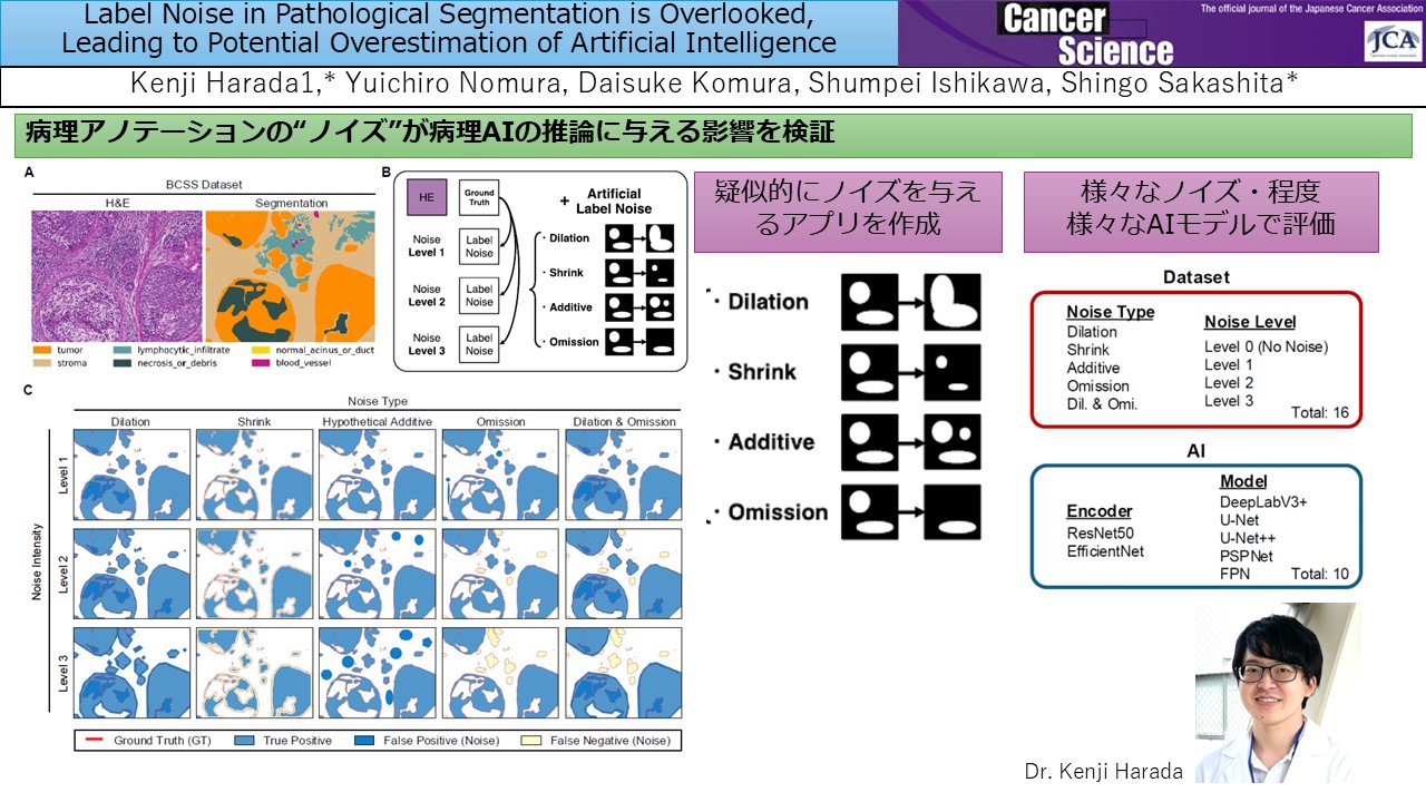 論文掲載】病理AIにおけるラベルノイズが性能評価の過大評価を招く可能性を指摘 | 先端医療開発センター