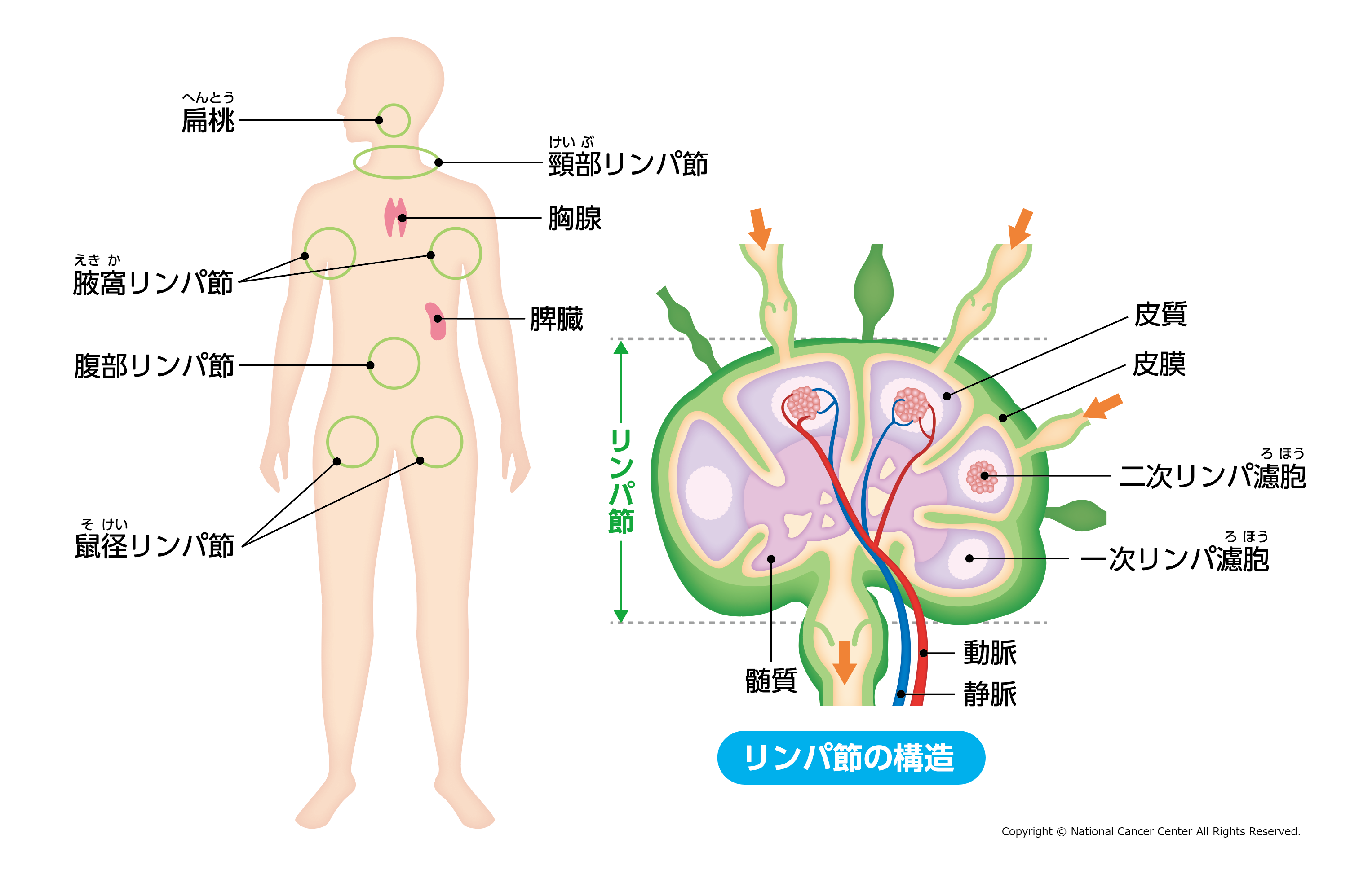 リンパ腫の病気について｜国立がん研究センター