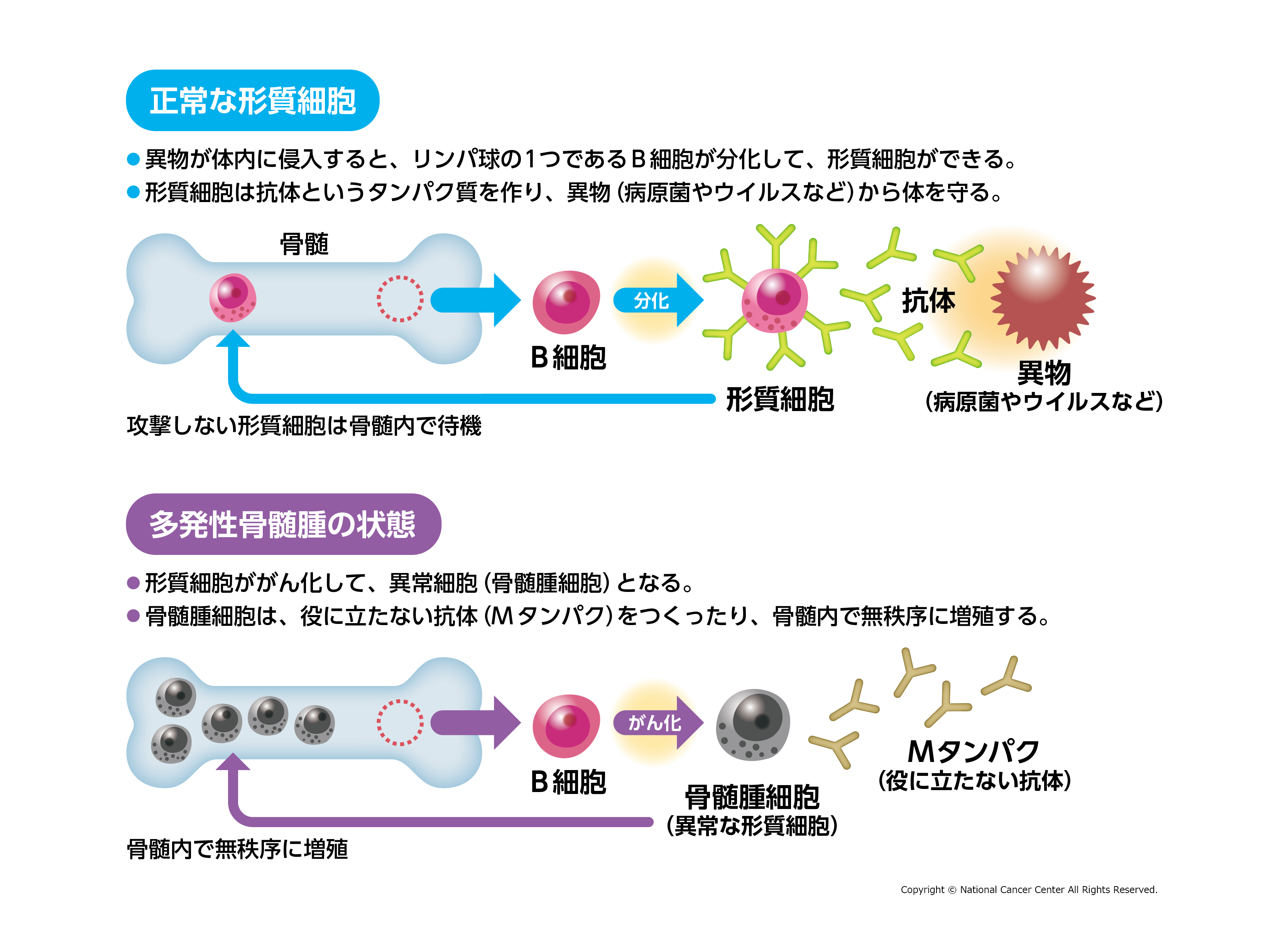 慢性骨髄性白血病の診断