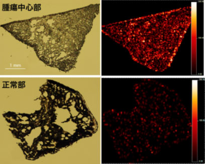 腫瘍組織中の薬物分布濃度を可視化する分子イメージング技術の確立により、ヒトの腫瘍組織中の薬物分布濃度と効果との関連の評価を開始 画像