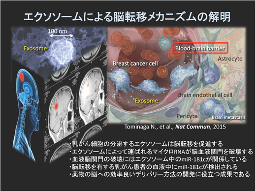 エクソソームによる脳転移メカニズムの解明