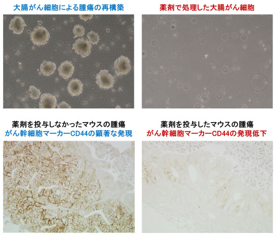 大腸がん幹細胞の機能を抑制路