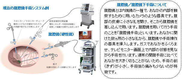 現在の腹腔鏡手術システム例