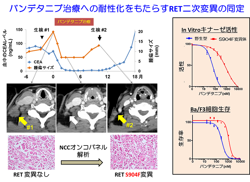 バンデタニブ治療への耐性化をもたらすRET二次変異の固定