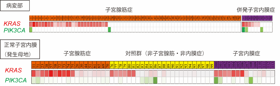 子宮腺筋症のゲノム解析図2