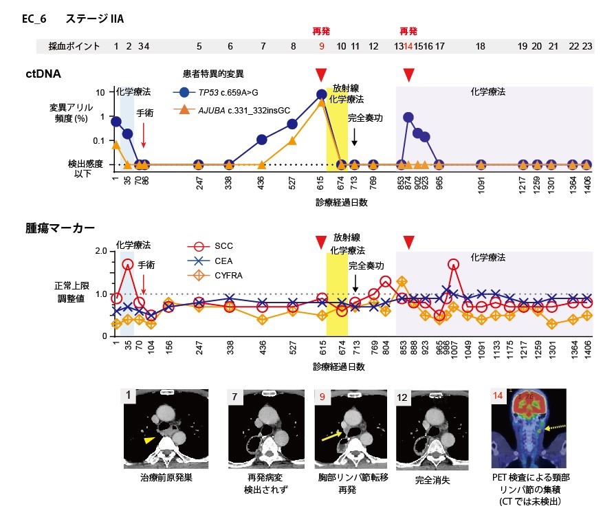 図2. 食道がん患者におけるctDNAモニタリングの一例