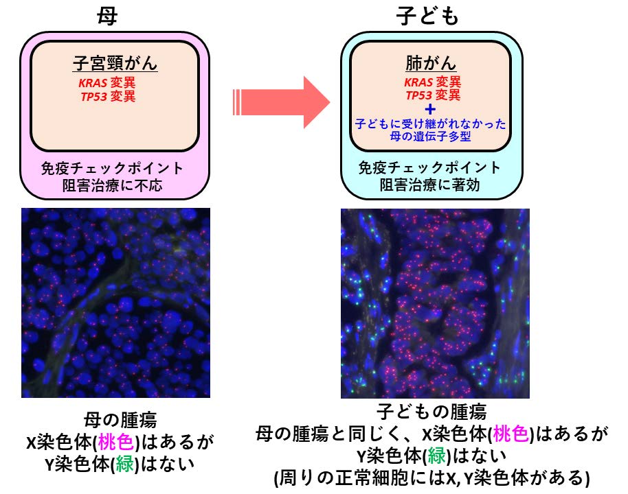 図1_母と子どもの腫瘍の特徴の比較