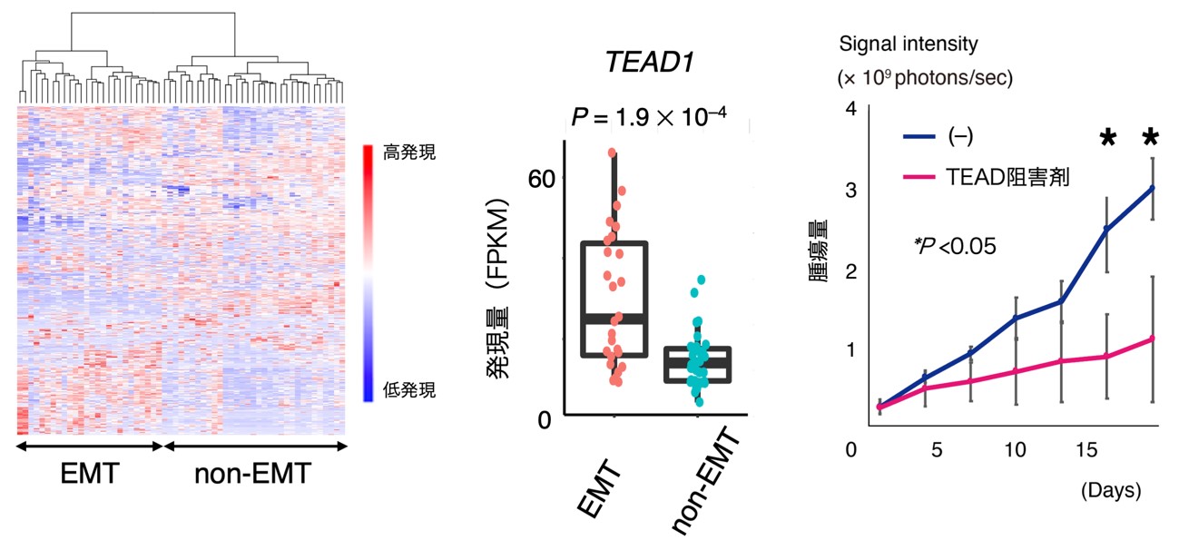 図4 EMTグループ胃がんの<em>TEAD</em>阻害剤による治療