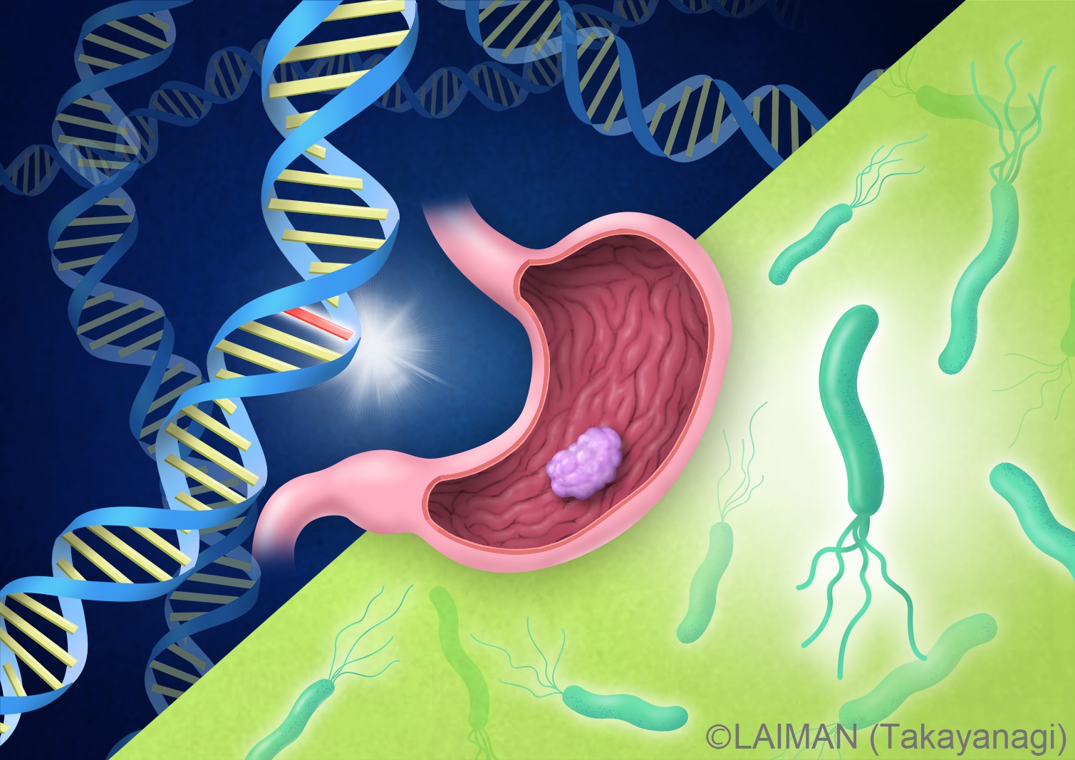 遺伝要因とピロリ菌感染による胃がんリスクの画像