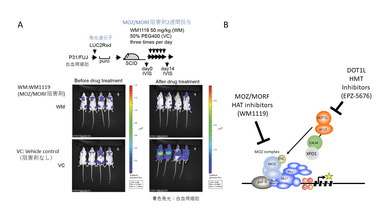 白血病を引き起こすタンパク質の機能の一端を解明 ～新たな治療法の