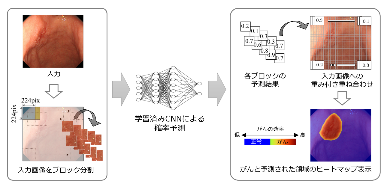 早期胃がんの領域予測のフロー