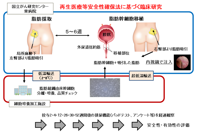 再生医療で前立腺がんの術後合併症の克服を目指す ～自己脂肪幹細胞を用いた臨床試験開始～