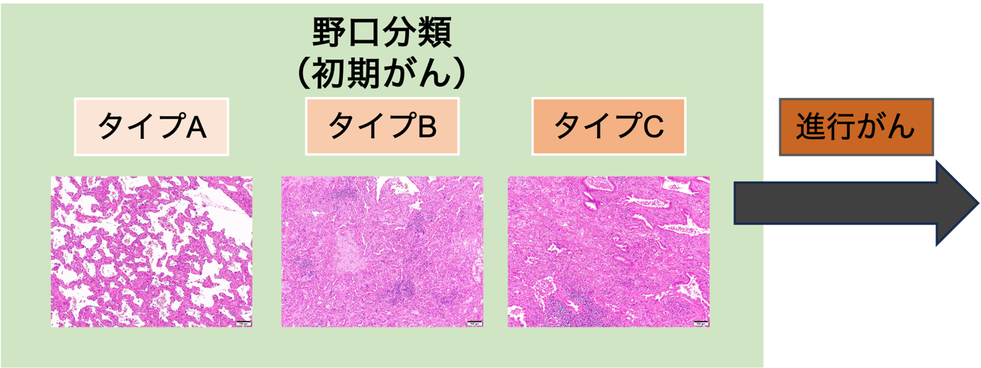 野口分類