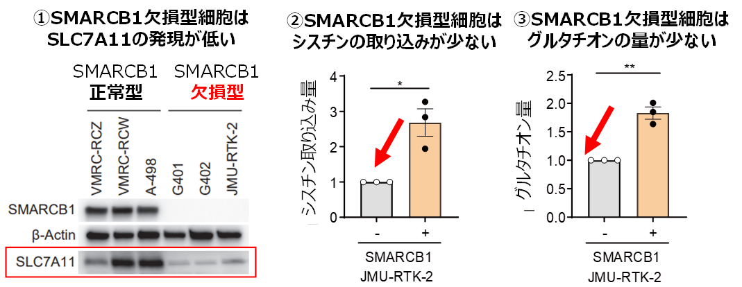 SMARCB1欠損希少がんの新たな治療標的を発見～グルタチオン代謝を標的としたGCLC阻害剤のフェロトーシス誘導を介した新たな作用機序を解明～