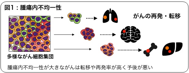 肺がんの術後再発を予測する新たな病理組織学的指標～ PD-L1タンパク質の空間的な腫瘍内不均一性～