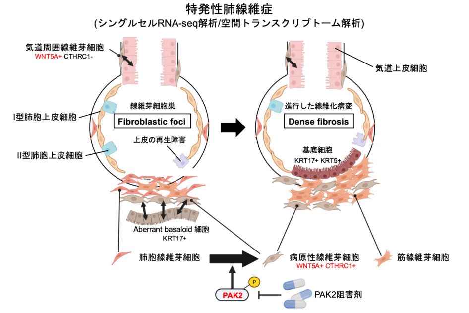 特発性肺線維症に対する新たな治療標的PAK2を発見～シングルセルRNA-seq解析および空間トランスクリプトーム解析技術を統合した最先端の手法により解明～