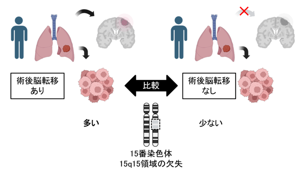 肺がんの脳転移に関与する遺伝子変化を特定～脳転移の予測・治療法の開発に期待～