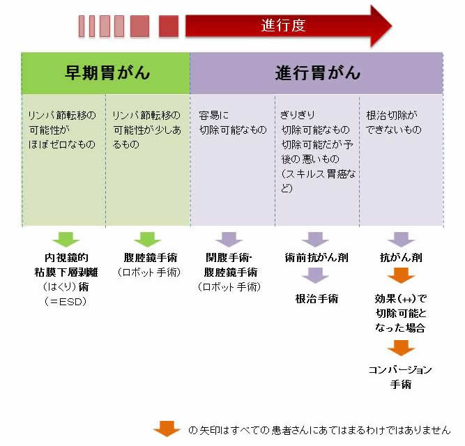 胃がんに対する治療方針