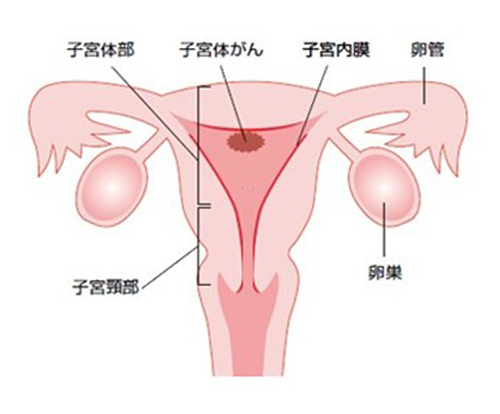Endometrial1