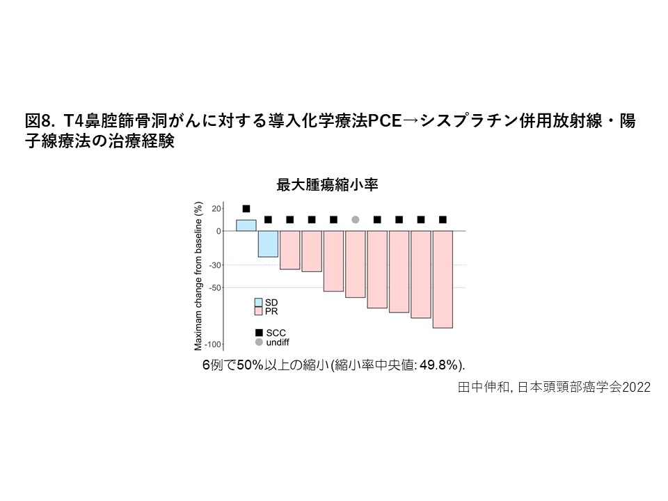 局所進行鼻腔がん