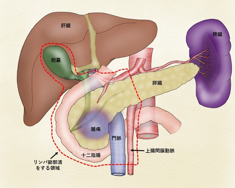 HPイラスト1