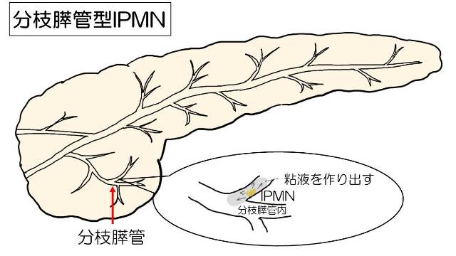 ipmn04.jpg