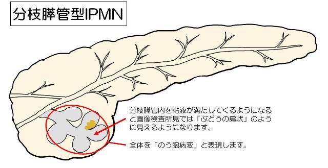 ない 腫瘍 いかん うと す にゅ うねん えき 和漢朗詠集