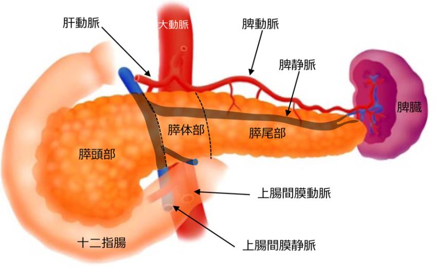 十二指腸 腫瘍