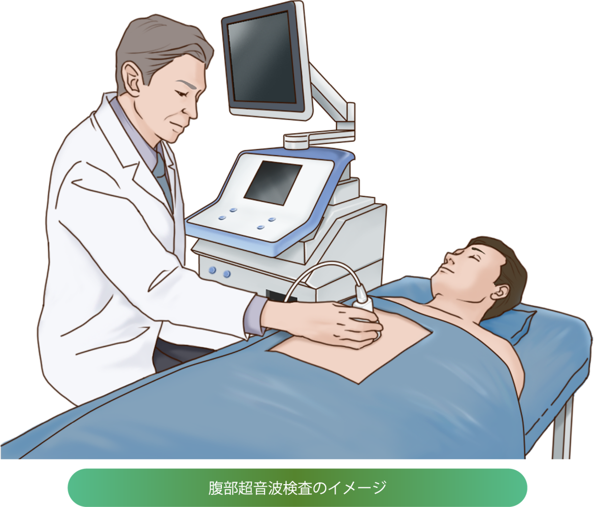 腹部超音波検査、超音波ガイド下肝腫瘍生検の画像