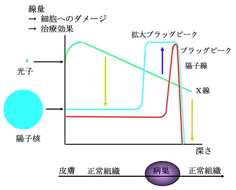 陽子線治療