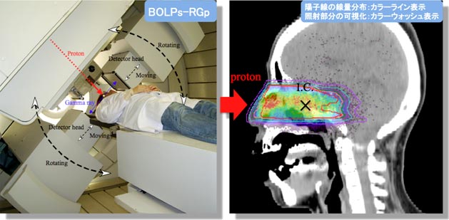 世界最先端の陽子線照射技術－その1（陽子線が照射された腫瘍部分を観る）