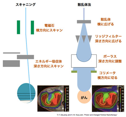 陽子線をがんの形に合わせる技術 図